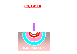 Psoben laseru